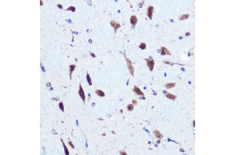 Immunohistochemistry - Anti-PCBP2/hnRNP E2 Antibody (A14039) - Antibodies.com