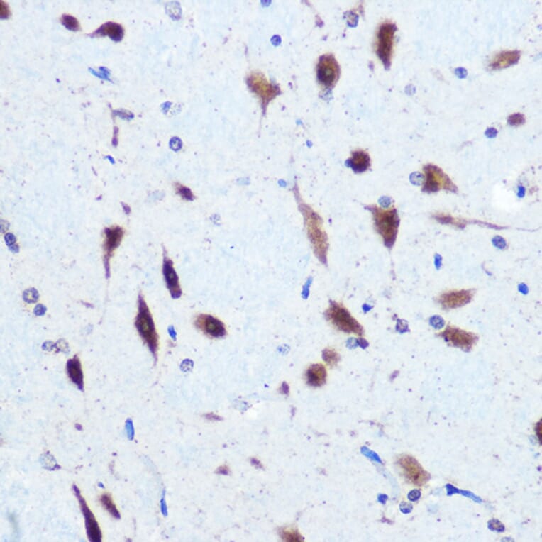 Immunohistochemistry - Anti-PCBP2/hnRNP E2 Antibody (A14039) - Antibodies.com