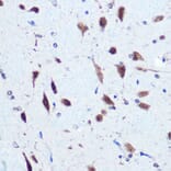 Immunohistochemistry - Anti-PCBP2/hnRNP E2 Antibody (A14039) - Antibodies.com