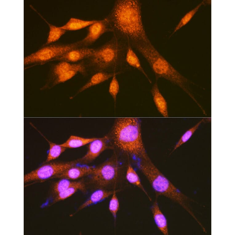 Immunofluorescence - Anti-PCBP2/hnRNP E2 Antibody (A14039) - Antibodies.com