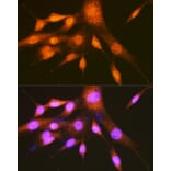 Immunofluorescence - Anti-PCBP2/hnRNP E2 Antibody (A14039) - Antibodies.com