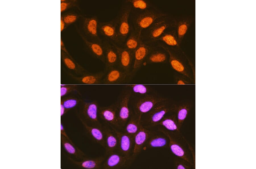 Immunofluorescence - Anti-PCBP2/hnRNP E2 Antibody (A14039) - Antibodies.com