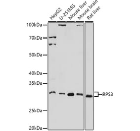 Western Blot - Anti-RPS3 Antibody (A14040) - Antibodies.com