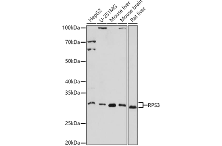 Western Blot - Anti-RPS3 Antibody (A14040) - Antibodies.com