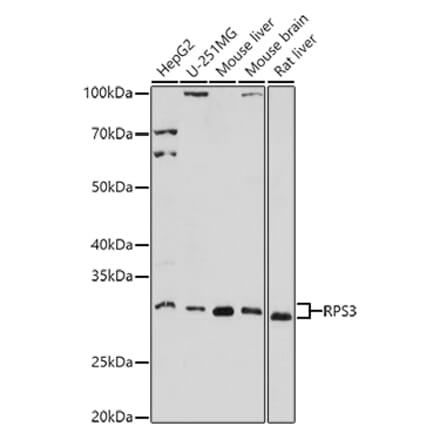 Western Blot - Anti-RPS3 Antibody (A14040) - Antibodies.com