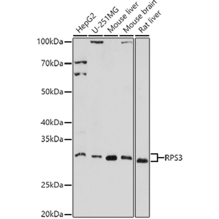 Western Blot - Anti-RPS3 Antibody (A14040) - Antibodies.com