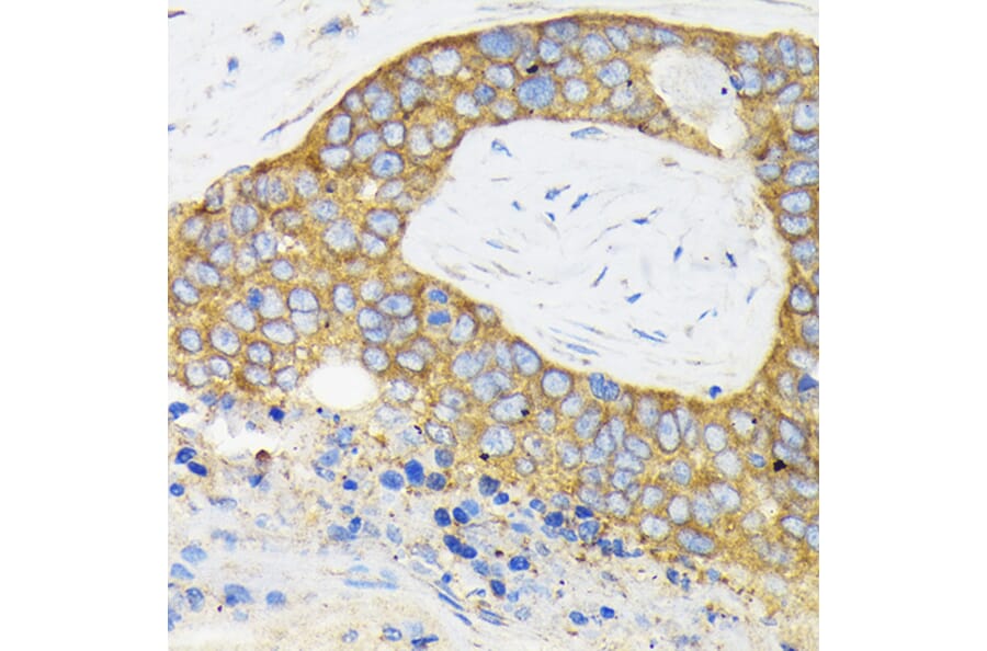Immunohistochemistry - Anti-RPS3 Antibody (A14040) - Antibodies.com