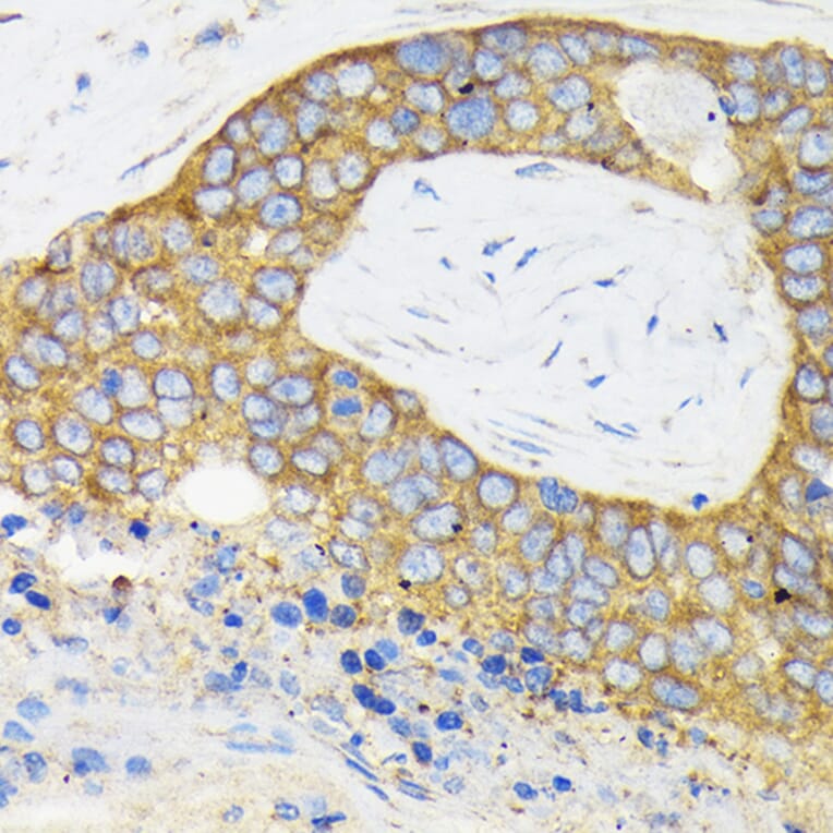 Immunohistochemistry - Anti-RPS3 Antibody (A14040) - Antibodies.com