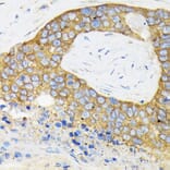 Immunohistochemistry - Anti-RPS3 Antibody (A14040) - Antibodies.com