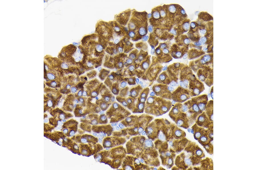 Immunohistochemistry - Anti-RPS3 Antibody (A14040) - Antibodies.com