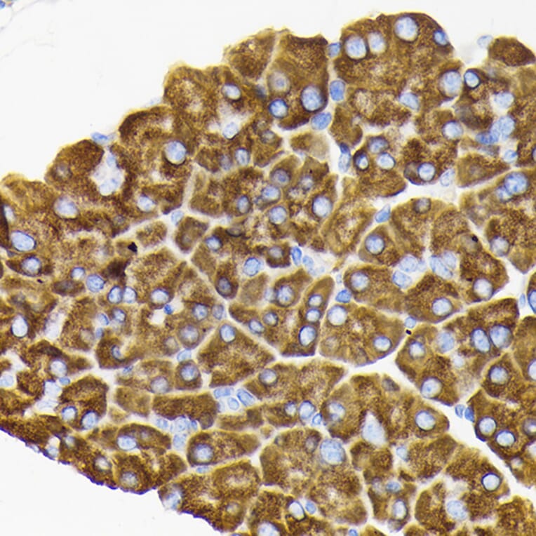 Immunohistochemistry - Anti-RPS3 Antibody (A14040) - Antibodies.com