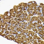 Immunohistochemistry - Anti-RPS3 Antibody (A14040) - Antibodies.com