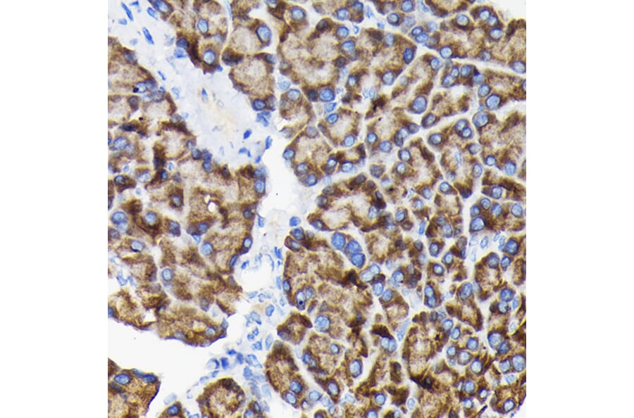 Immunohistochemistry - Anti-RPS3 Antibody (A14040) - Antibodies.com