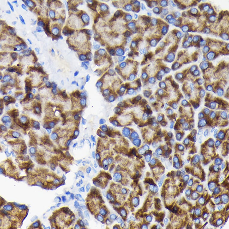 Immunohistochemistry - Anti-RPS3 Antibody (A14040) - Antibodies.com