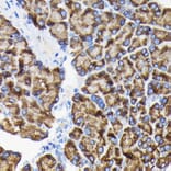 Immunohistochemistry - Anti-RPS3 Antibody (A14040) - Antibodies.com