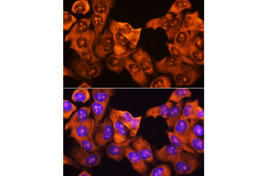 Immunofluorescence - Anti-RPS3 Antibody (A14040) - Antibodies.com