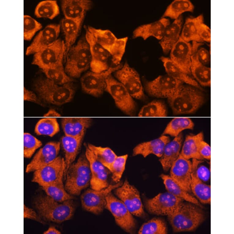 Immunofluorescence - Anti-RPS3 Antibody (A14040) - Antibodies.com