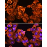 Immunofluorescence - Anti-RPS3 Antibody (A14040) - Antibodies.com