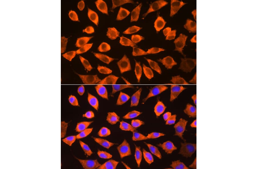 Immunofluorescence - Anti-RPS3 Antibody (A14040) - Antibodies.com