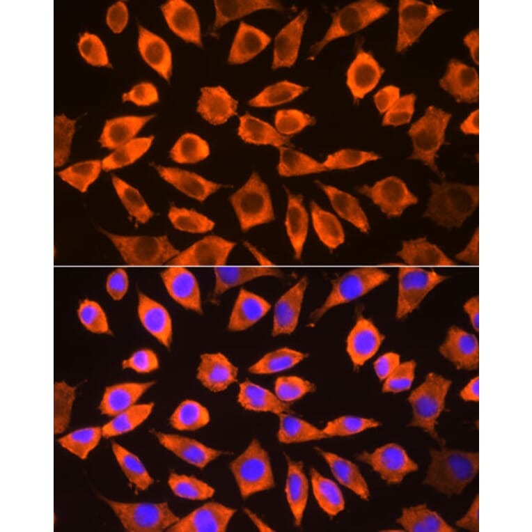 Immunofluorescence - Anti-RPS3 Antibody (A14040) - Antibodies.com