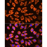 Immunofluorescence - Anti-RPS3 Antibody (A14040) - Antibodies.com