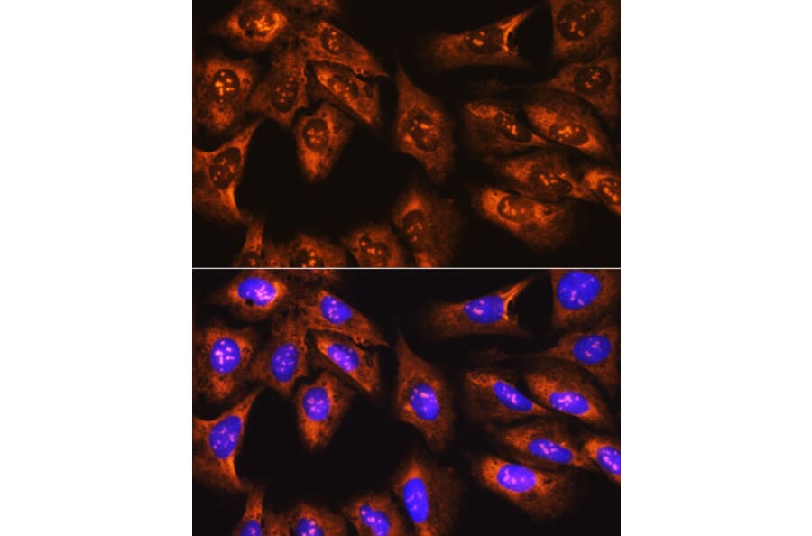 Immunofluorescence - Anti-RPS3 Antibody (A14040) - Antibodies.com
