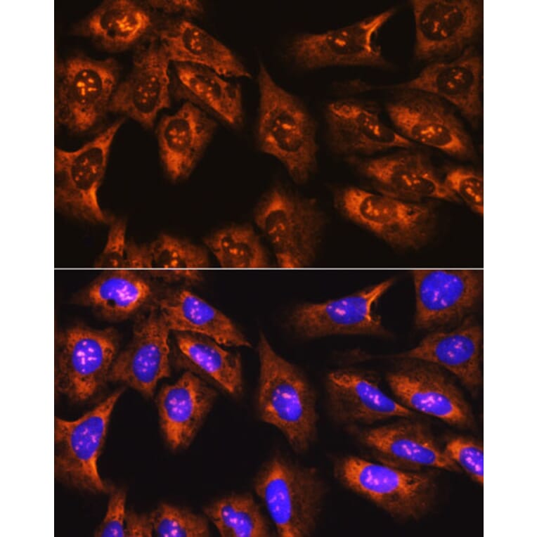 Immunofluorescence - Anti-RPS3 Antibody (A14040) - Antibodies.com