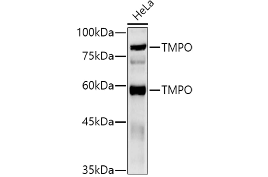 Western Blot - Anti-LAP2 Antibody (A14041) - Antibodies.com