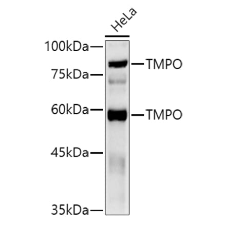 Western Blot - Anti-LAP2 Antibody (A14041) - Antibodies.com