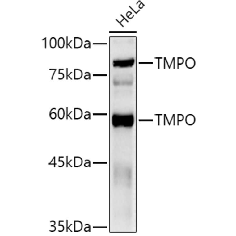 Western Blot - Anti-LAP2 Antibody (A14041) - Antibodies.com