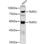 Western Blot - Anti-LAP2 Antibody (A14041) - Antibodies.com