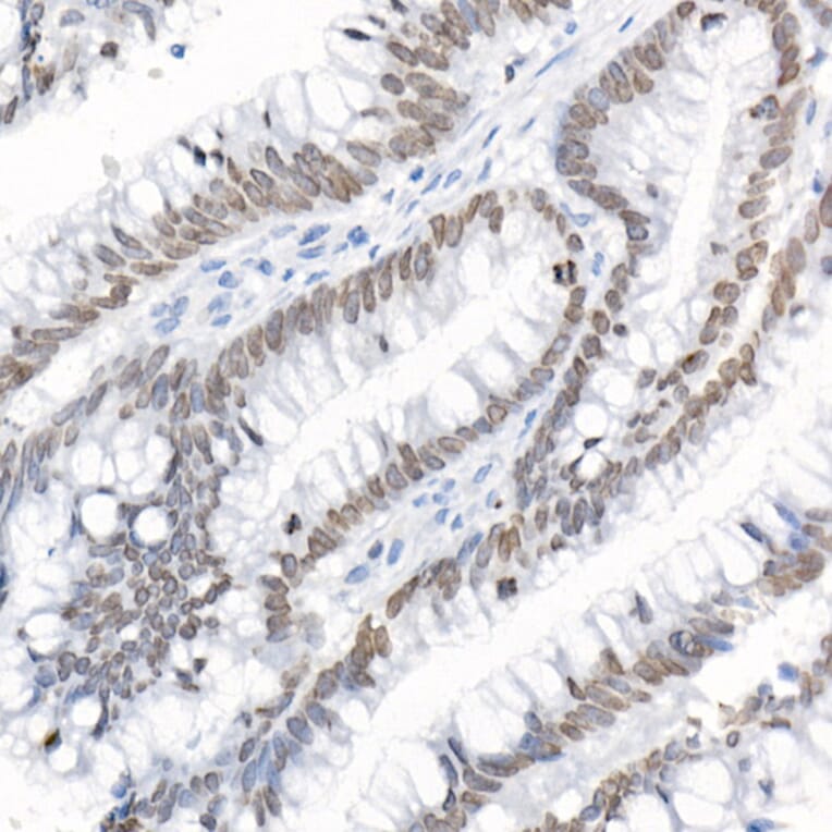 Immunohistochemistry - Anti-LAP2 Antibody (A14041) - Antibodies.com