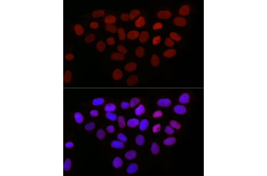 Immunofluorescence - Anti-LAP2 Antibody (A14041) - Antibodies.com