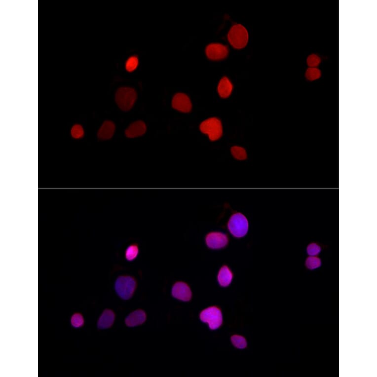 Immunofluorescence - Anti-LAP2 Antibody (A14041) - Antibodies.com