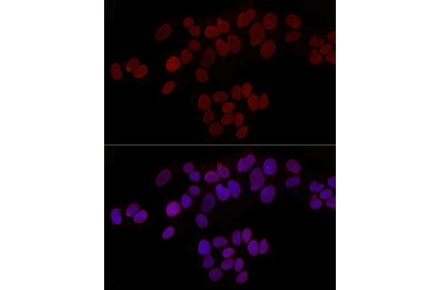 Immunofluorescence - Anti-LAP2 Antibody (A14041) - Antibodies.com