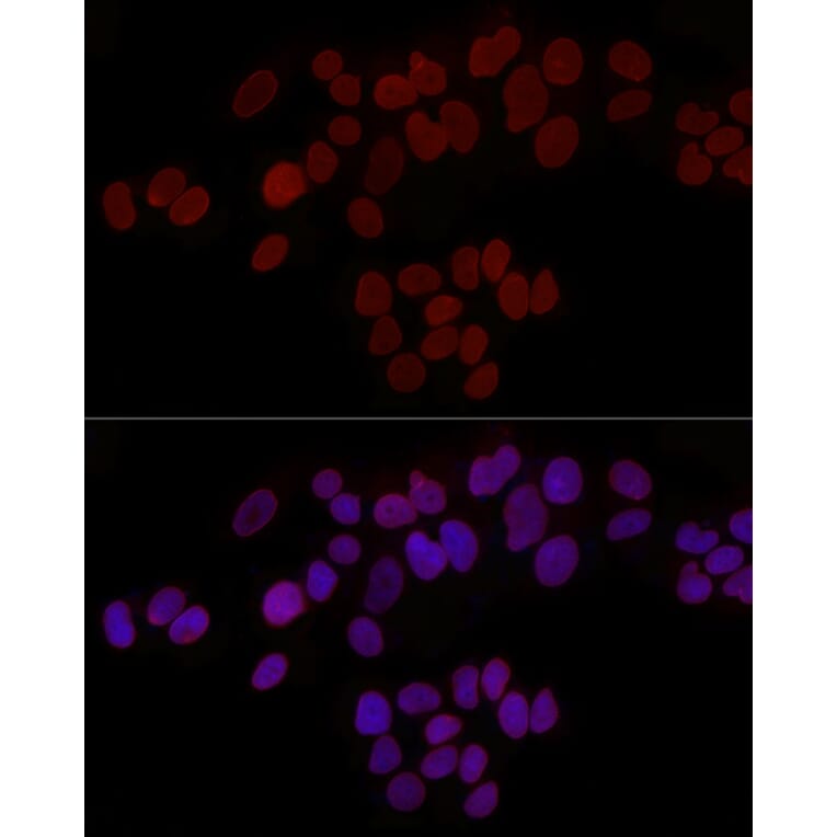 Immunofluorescence - Anti-LAP2 Antibody (A14041) - Antibodies.com