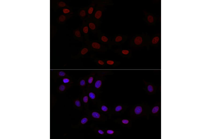 Immunofluorescence - Anti-LAP2 Antibody (A14041) - Antibodies.com