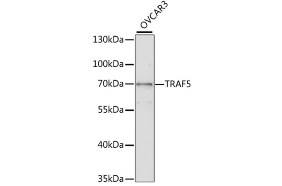 Western Blot - Anti-TRAF5 Antibody (A2536) - Antibodies.com