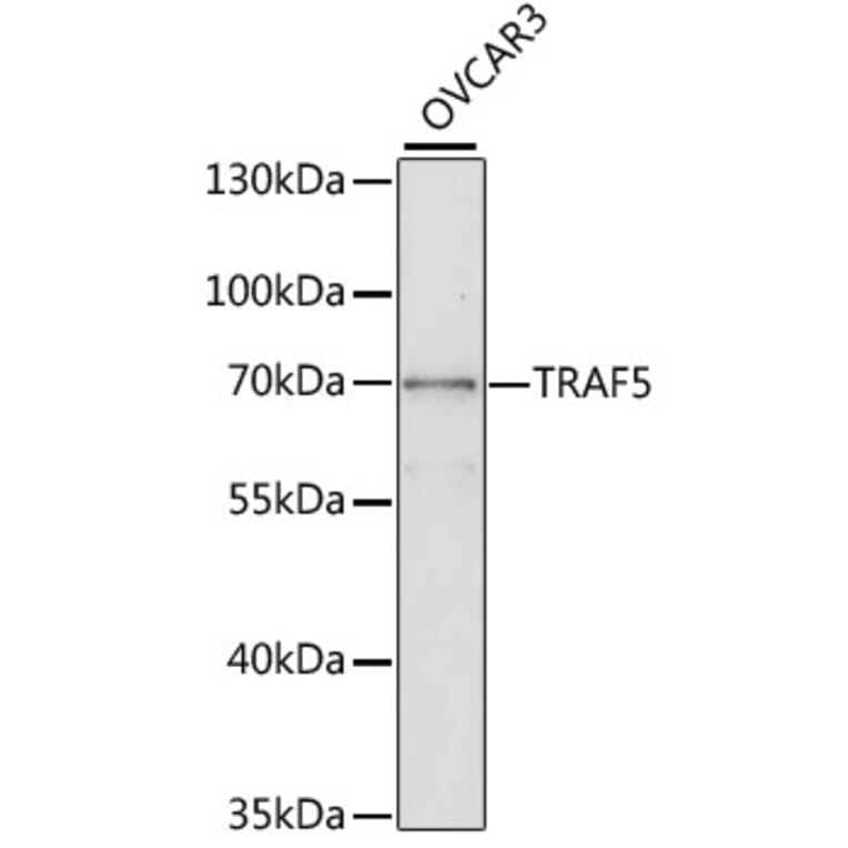 Western Blot - Anti-TRAF5 Antibody (A2536) - Antibodies.com