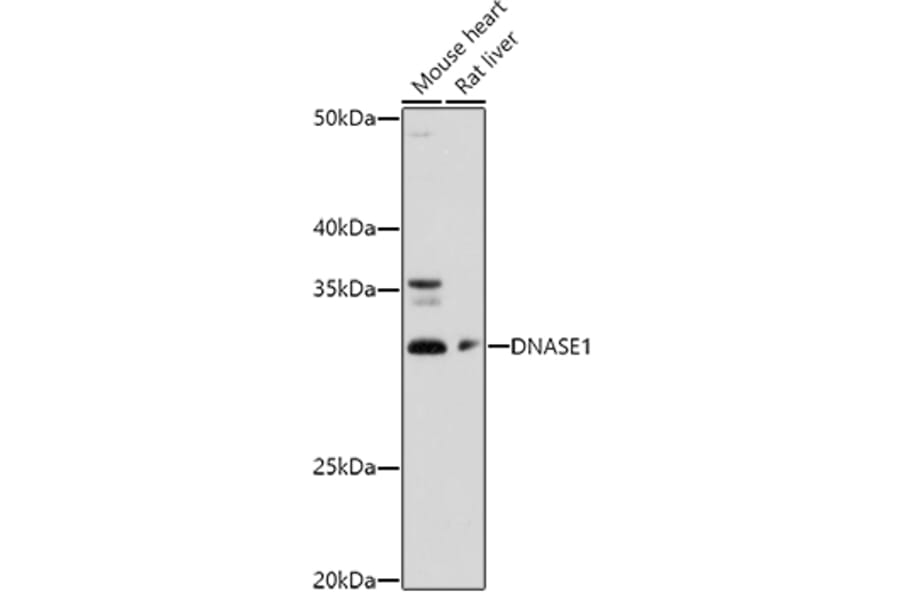 Western Blot - Anti-DNase I Antibody (A14043) - Antibodies.com