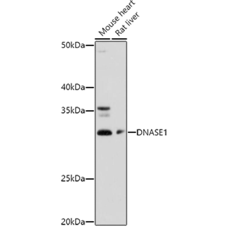 Western Blot - Anti-DNase I Antibody (A14043) - Antibodies.com