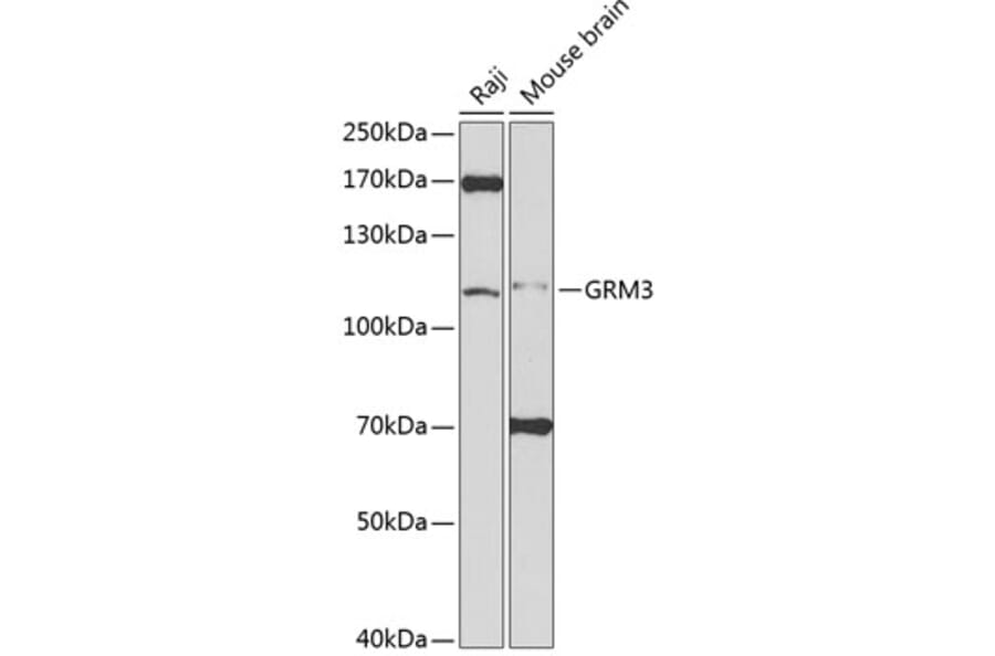Western Blot - Anti-Metabotropic Glutamate Receptor 3/MGLUR3 Antibody (A14044) - Antibodies.com
