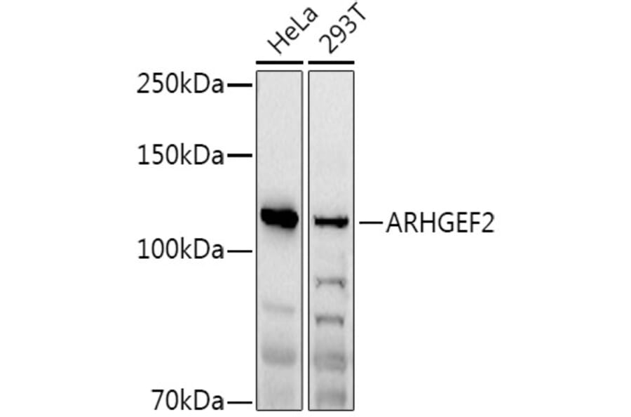 Western Blot - Anti-GEF-H1 Antibody (A14045) - Antibodies.com