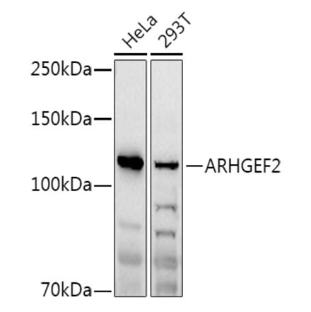 Western Blot - Anti-GEF-H1 Antibody (A14045) - Antibodies.com