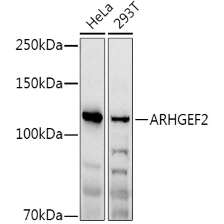 Western Blot - Anti-GEF-H1 Antibody (A14045) - Antibodies.com