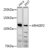 Western Blot - Anti-GEF-H1 Antibody (A14045) - Antibodies.com