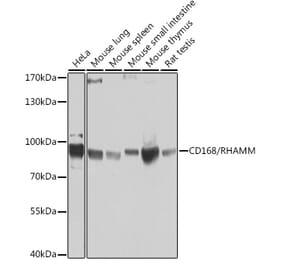 Western Blot - Anti-CD168 Antibody (A14046) - Antibodies.com