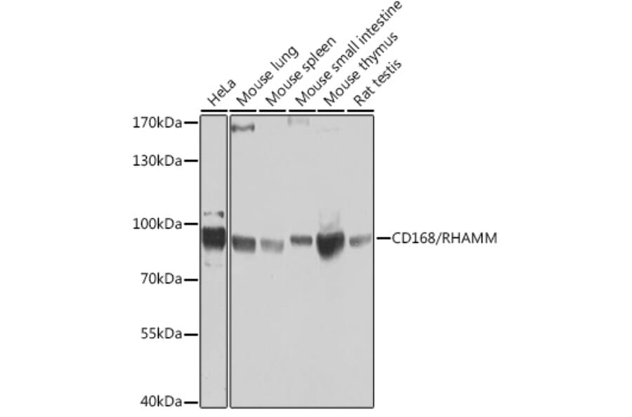 Western Blot - Anti-CD168 Antibody (A14046) - Antibodies.com