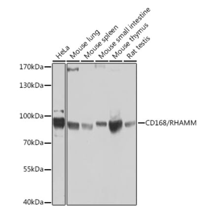 Western Blot - Anti-CD168 Antibody (A14046) - Antibodies.com