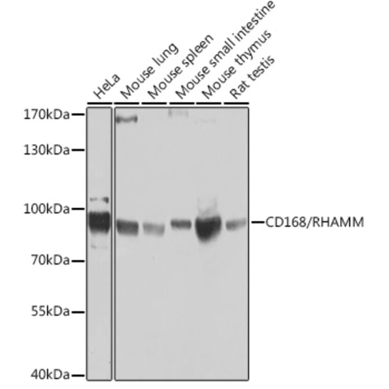 Western Blot - Anti-CD168 Antibody (A14046) - Antibodies.com